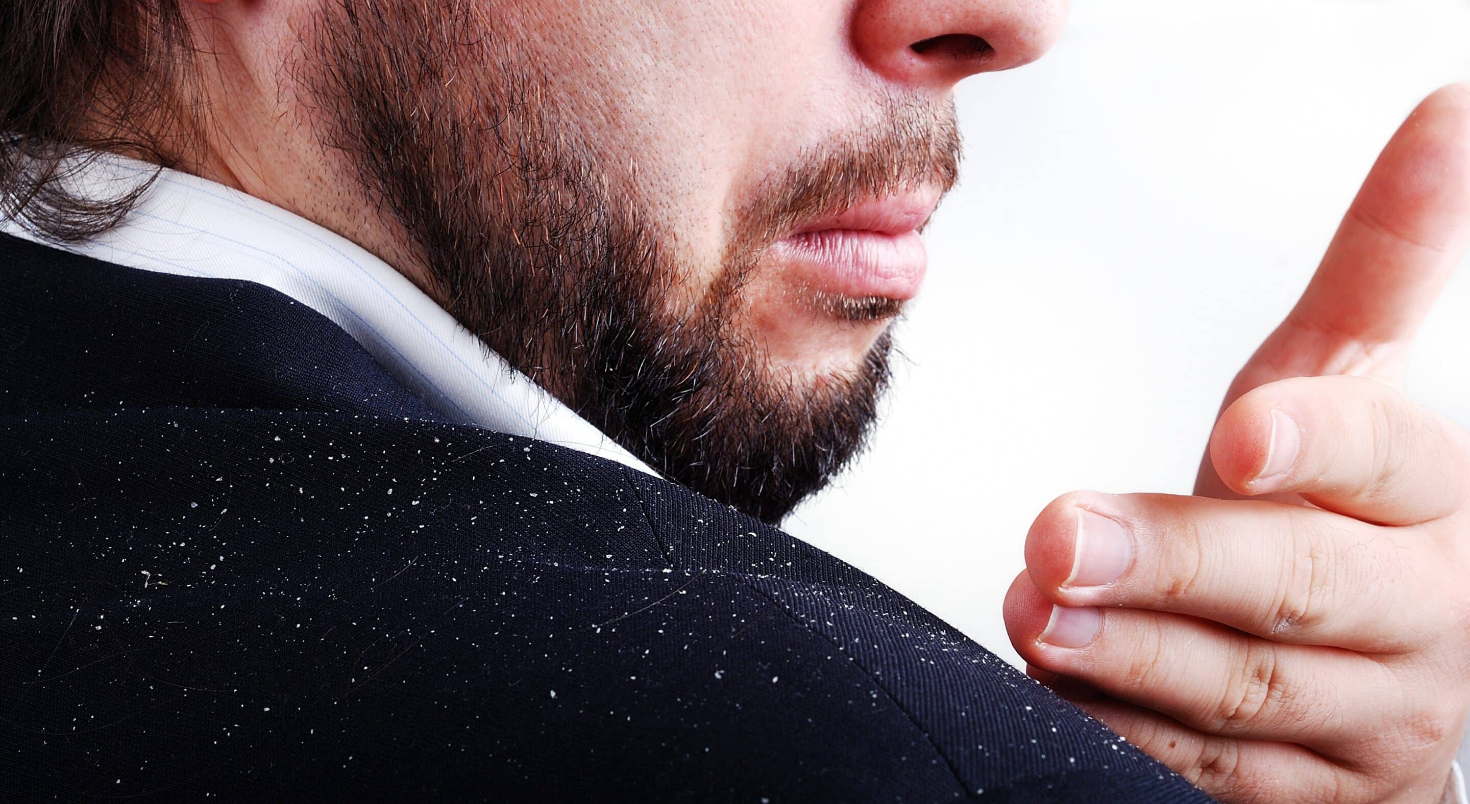 Man brushing dandruff off his shoulder